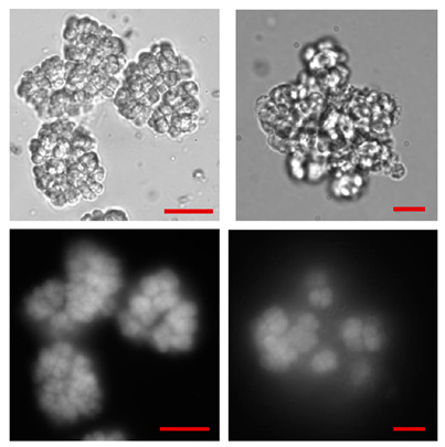 Methanosarcinabarkeri (DSM 1538) in autotrophic culture conditions Phase contrast (top line), Epifluorescence (lower line) Methanosarcinabarkeri (DSM 1538) in autotrophic culture conditions Phase contrast (top line), Epifluorescence (lower line)